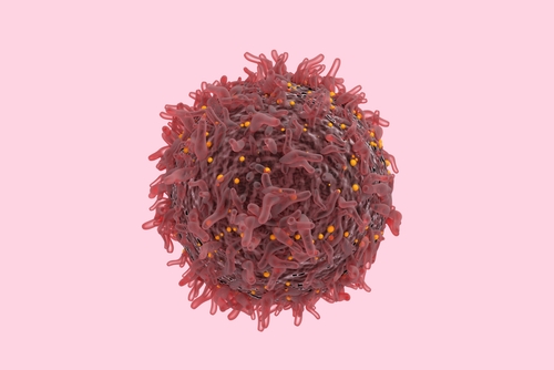 Linfoma: valore clinico patologico e prognostico del punteggio CONUT