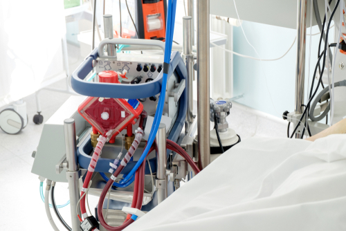 ECMO in pazienti trattati con trapianto di cellule staminali ematopoietiche o Car-T