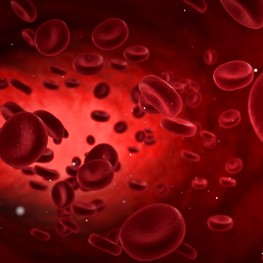 Linfoma diffuso a grandi cellule B: valore prognostico dell’ampiezza di distribuzione dei globuli rossi e del D-dimero