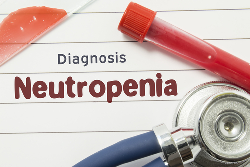 Neutropenia e prognosi nelle persone con HIV/AIDS