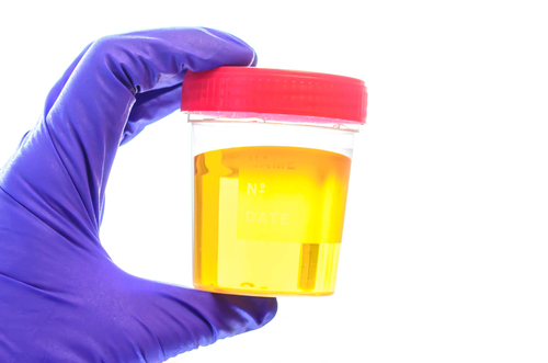 I composti organici volatili sono associate alla DA nei bambini