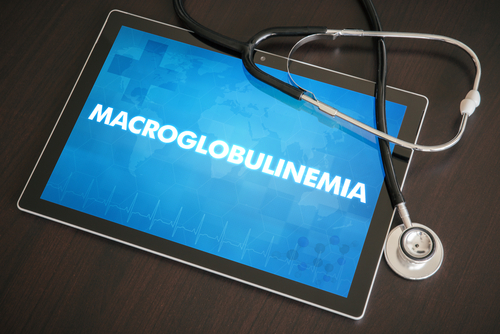 Macroglobulinemia di Waldenström: confronto tra BTKi di prima e seconda generazione