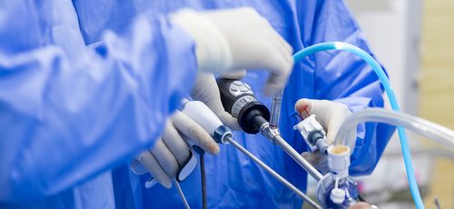 Tumori neuroendocrini pancreatici non funzionanti: la chirurgia mininvasiva è sicura ed efficace