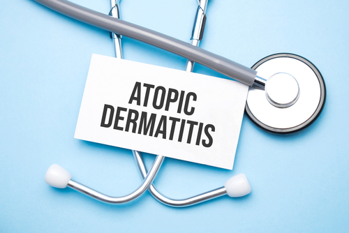 Qualità della vita e gravità della DA: come si correlano gli indici