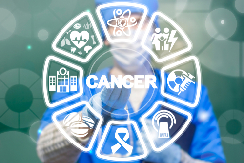 Tumori da terapie immunosoppressive in pazienti con IBD e cancro: nessuna associazione