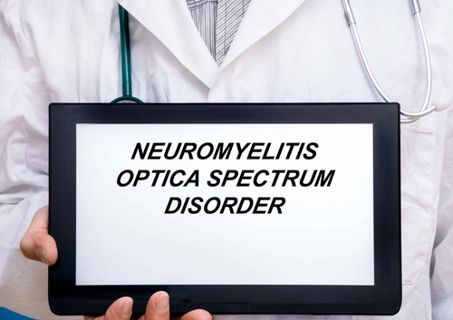 Car-T anti-BCMA nei disturbi dello spettro della neuromielite ottica