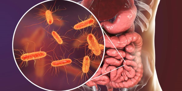 Ferro e microbioma, quale relazione