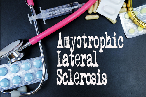 Potenzialità della psicoterapia psichedelica assistita nel trattamento della SLA