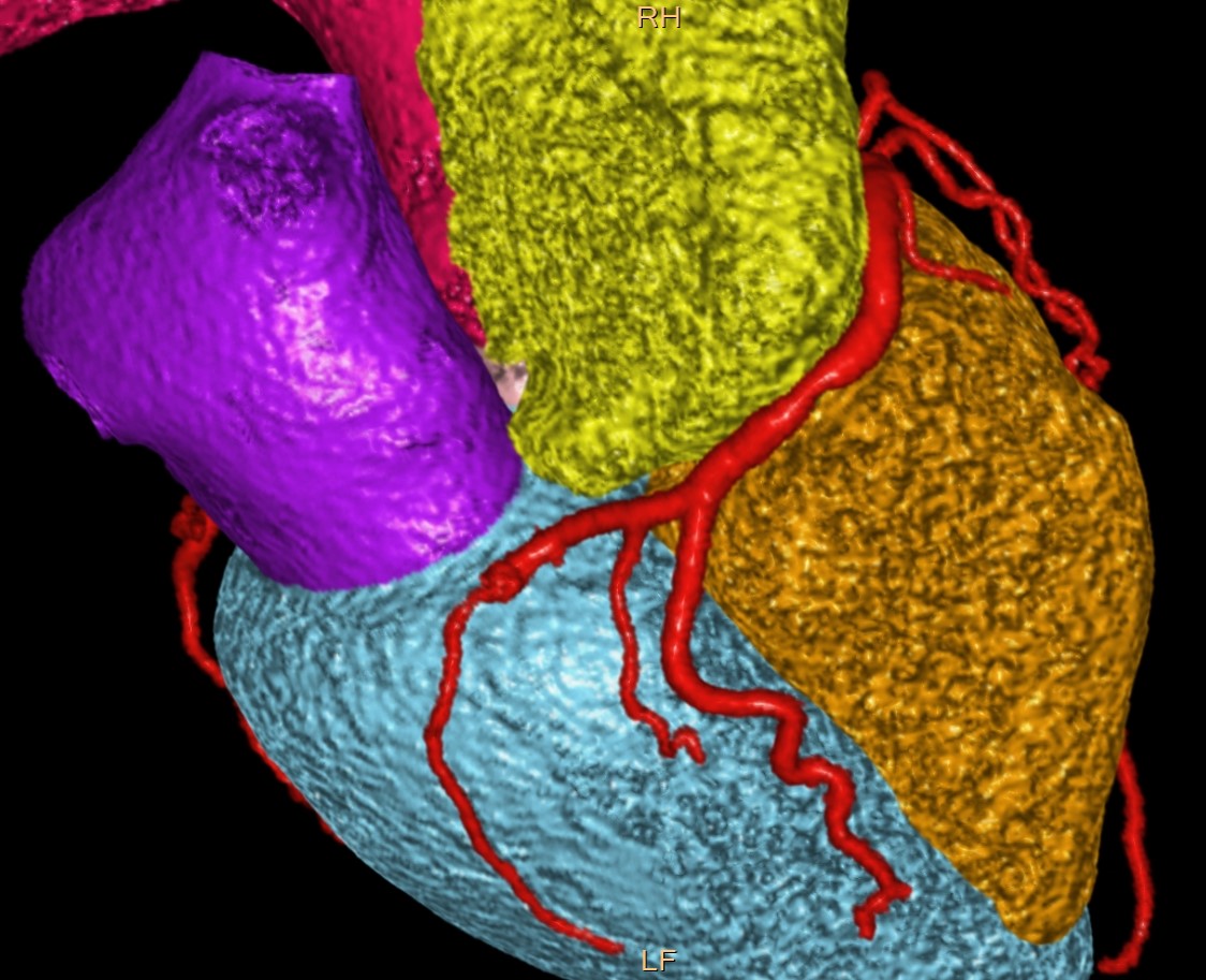 Imaging cardiovascolare sempre più rilevante per diagnosi e trattamento