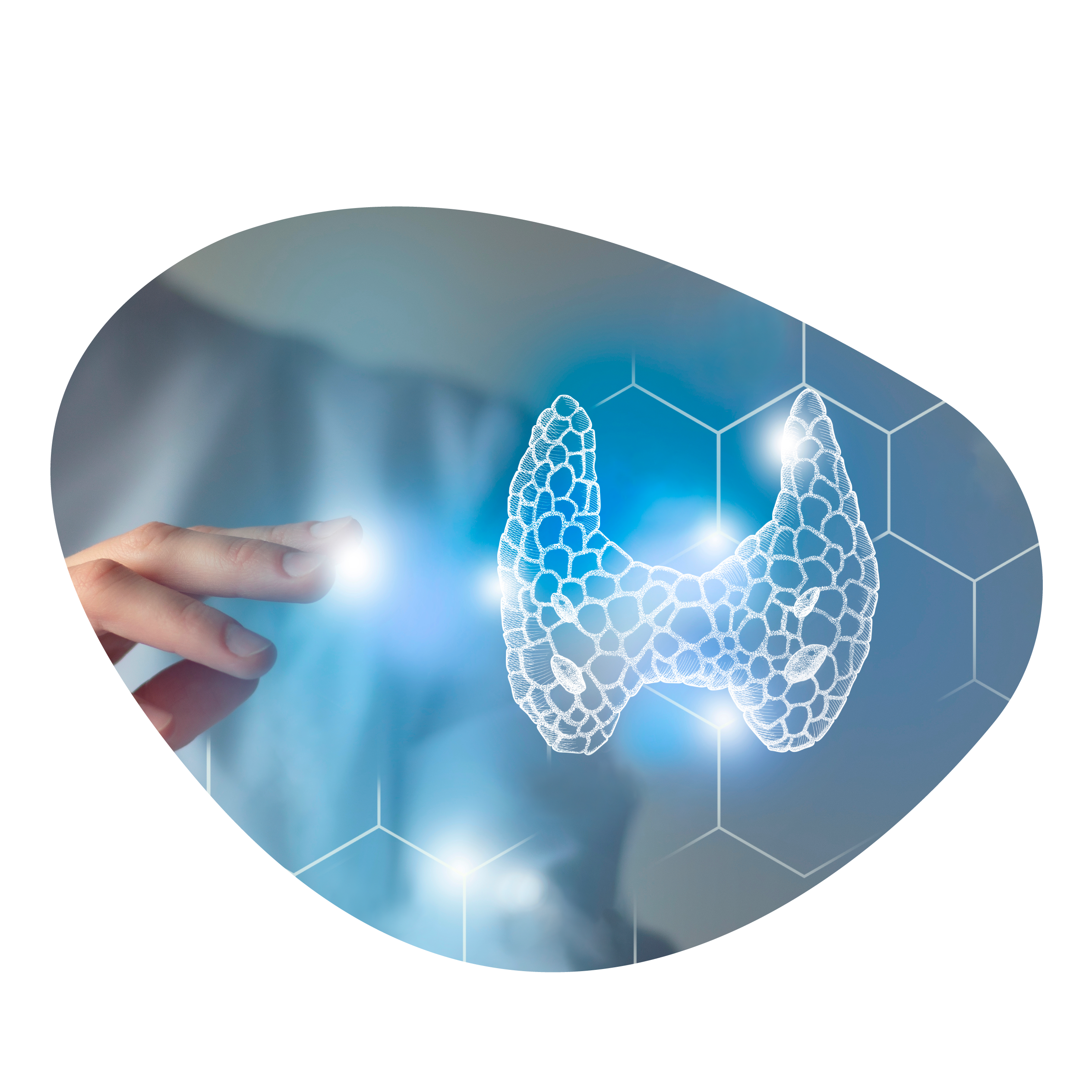 Assistenza psicologica e nutrizionale supportano benefici post intervento per carcinoma tiroideo