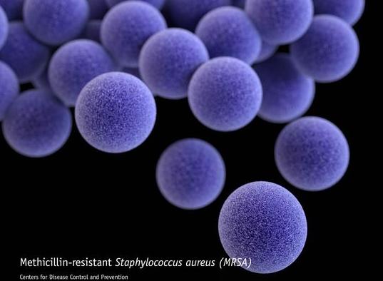 S. aureus: verso la progettazione di vaccini di prossima generazione