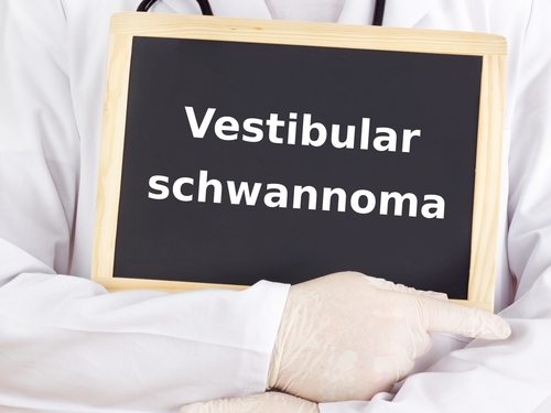 Schwannoma vestibolare: miglioramenti dopo l’approccio via fossa cranica media