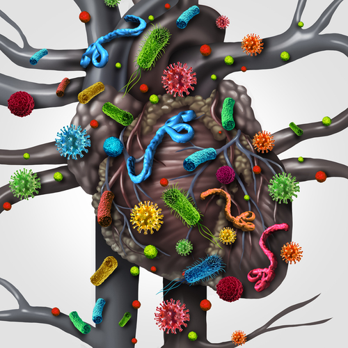 Aumentato rischio di batteriemia ed endocardite dopo TAVI rispetto alla coronarografia