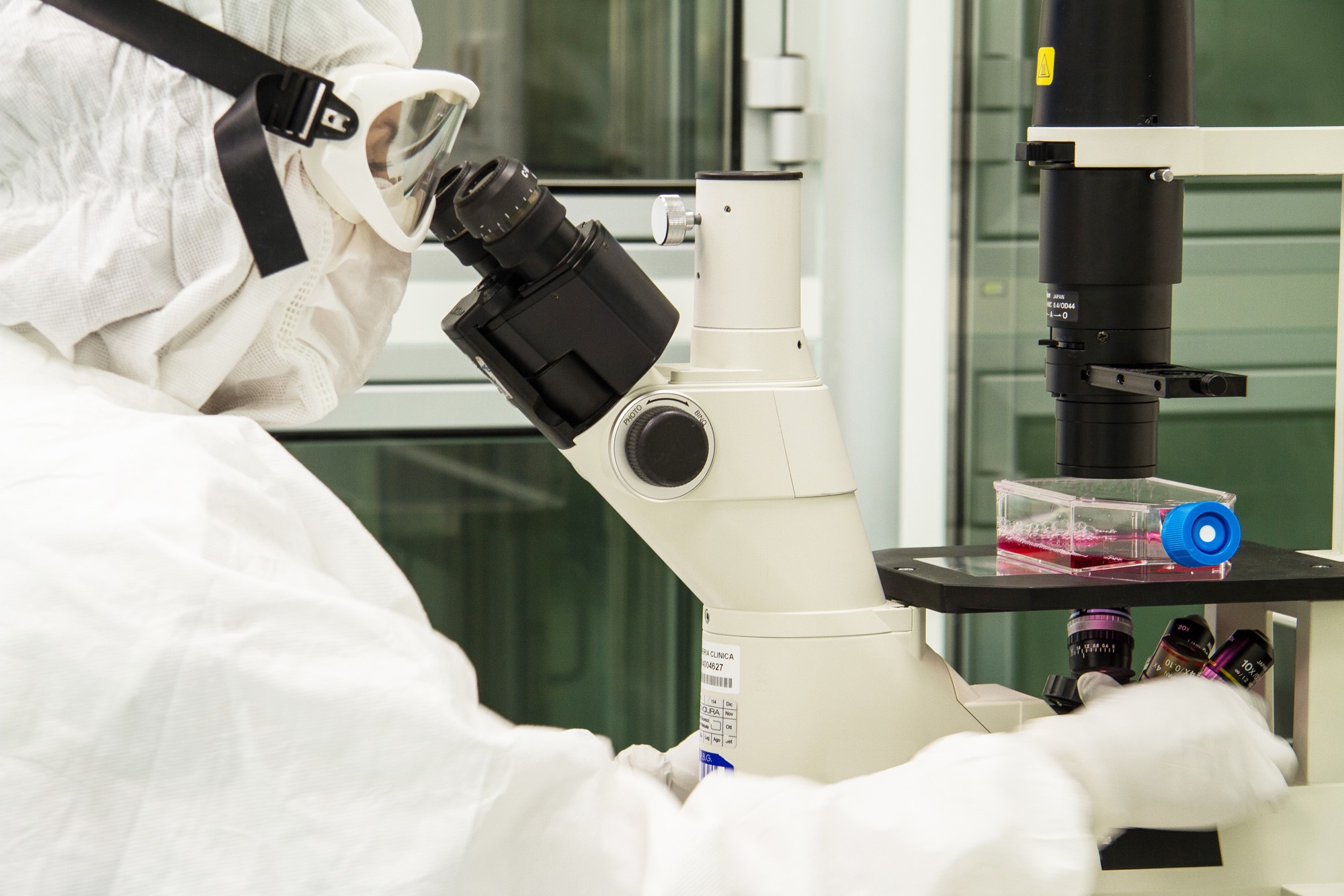 Un trapianto di pelle geneticamente modificata per l’epidermolisi bollosa distrofica recessiva